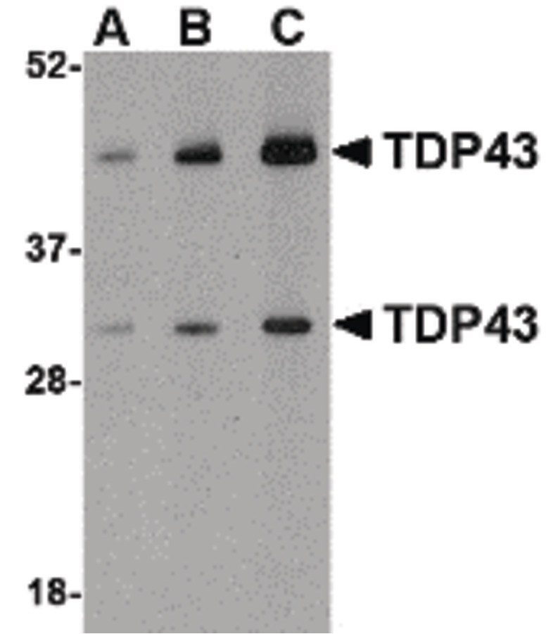 Western blot of TDP43 in HeLa cell lysate with TDP43 antibody at (A) 0.5, (B) 1 and (C) 2 ug/ml.