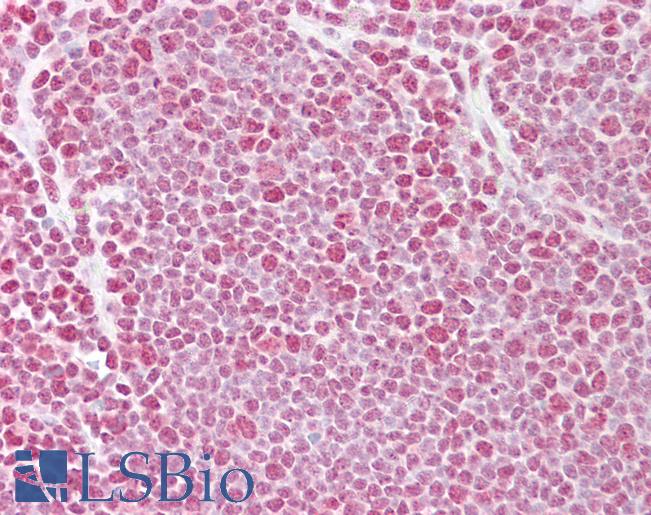 Anti-TARDBP antibody IHC of human thymus. Immunohistochemistry of formalin-fixed, paraffin-embedded tissue after heat-induced antigen retrieval. Antibody LS-B6796 concentration 5 ug/ml.