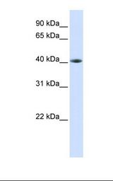 Fetal muscle lysate. Antibody concentration: 1.0 ug/ml. Gel concentration: 12%.