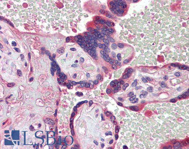 Anti-TDP1 antibody IHC of human placenta. Immunohistochemistry of formalin-fixed, paraffin-embedded tissue after heat-induced antigen retrieval. Antibody LS-B3586 concentration 5 ug/ml.