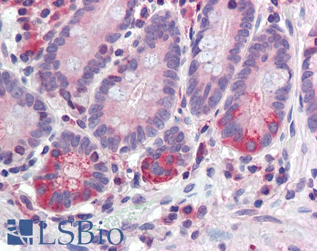 Anti-TDP1 antibody IHC of human small intestine. Immunohistochemistry of formalin-fixed, paraffin-embedded tissue after heat-induced antigen retrieval. Antibody LS-B3586 concentration 5 ug/ml.