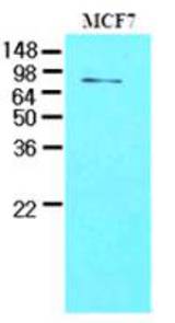 Western analysis of MCF cell lysates.