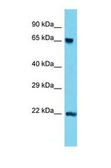 Western blot of Mouse Lung. Tdp1 antibody dilution 1.0 ug/ml.