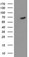 HEK293T cells were transfected with the pCMV6-ENTRY control (Left lane) or pCMV6-ENTRY TDP1 (Right lane) cDNA for 48 hrs and lysed. Equivalent amounts of cell lysates (5 ug per lane) were separated by SDS-PAGE and immunoblotted with anti-TDP1.