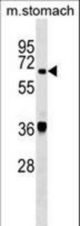 TDP1 Antibody western blot of mouse stomach tissue lysates (35 ug/lane). The TDP1 antibody detected the TDP1 protein (arrow).