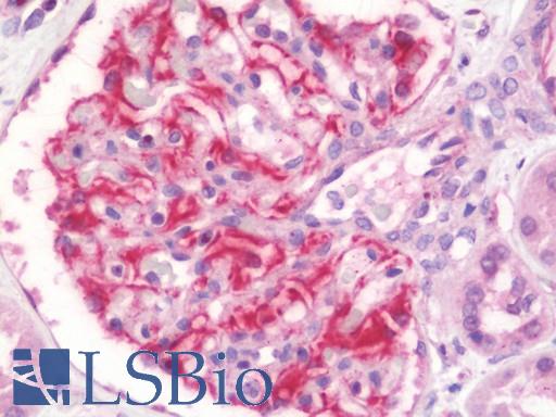 Anti-TDP2 / TTRAP antibody IHC staining of human kidney. Immunohistochemistry of formalin-fixed, paraffin-embedded tissue after heat-induced antigen retrieval. Antibody LS-B10866 concentration 7.5 ug/ml.