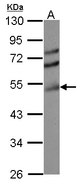 Sample (30 ug of whole cell lysate) A: HCT116 10% SDS PAGE TDP2 / TTRAP antibody diluted at 1:3000