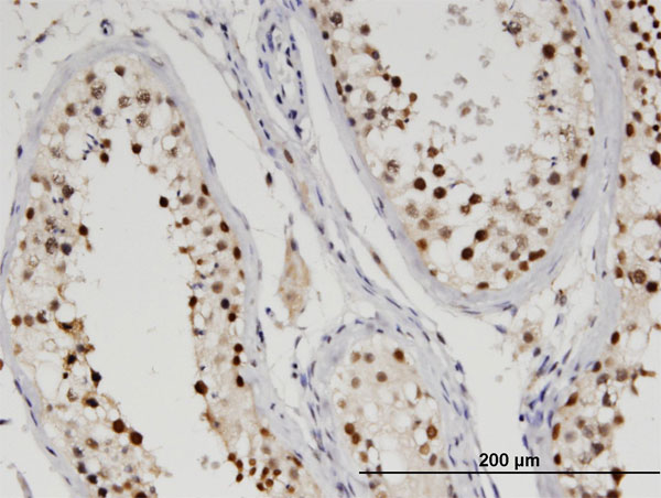Immunoperoxidase of monoclonal antibody to TTRAP on formalin-fixed paraffin-embedded human testis. [antibody concentration 1.5 ug/ml]