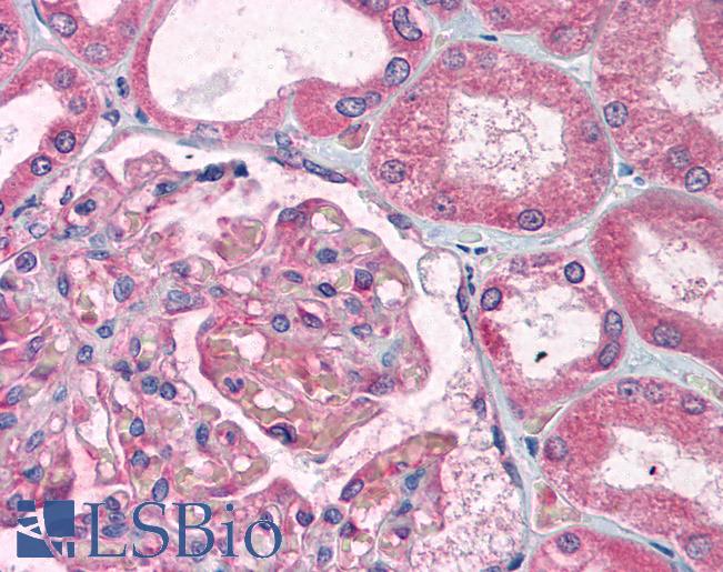 Anti-TDP2 / TTRAP antibody IHC of human kidney. Immunohistochemistry of formalin-fixed, paraffin-embedded tissue after heat-induced antigen retrieval. Antibody LS-B1624 concentration 5 ug/ml.