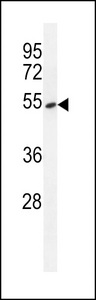 EAPII Antibody western blot of A549 cell line lysates (35 ug/lane). The EAPII antibody detected the EAPII protein (arrow).