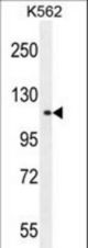 TDRD1 Antibody western blot of K562 cell line lysates (35 ug/lane). The TDRD1 antibody detected the TDRD1 protein (arrow).