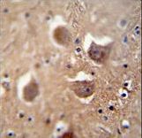 TDRD7 antibody immunohistochemistry of formalin-fixed and paraffin-embedded human brain tissue followed by peroxidase-conjugated secondary antibody and DAB staining.