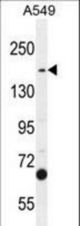 TDRD7 Antibody western blot of A549 cell line lysates (35 ug/lane). The TDRD7 antibody detected the TDRD7 protein (arrow).