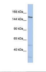 Western blot of Human ACHN. TDRD9 antibody dilution 1.0 ug/ml.