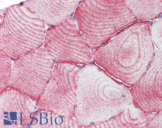 Anti-TEAD1 antibody IHC of human skeletal muscle. Immunohistochemistry of formalin-fixed, paraffin-embedded tissue after heat-induced antigen retrieval. Antibody LS-B3534 concentration 5 ug/ml.
