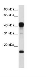 Fetal Muscle Lysate.