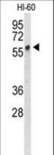 Western blot of PLVAP Antibody in HL-60 cell line lysates (35 ug/lane). PLVAP (arrow) was detected using the purified antibody.