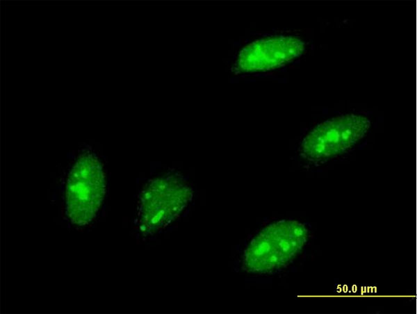Immunofluorescence of monoclonal antibody to TEAD3 on HeLa cell . [antibody concentration 10 ug/ml]
