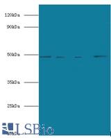 Western blot of Transcriptional enhancer factor TEF-5 antibody at 2 ug/ml lane 1: HepG2 whole cell lysate lane 2: mouse small intestine tissue Lane 3: 293t whole cell lysate Lane 4: HeLa whole cell lysate secondary Goat polyclonal to rabbit at 1:10000 dilution predicted band size: 49 KDa observed band size: 49 KDa.