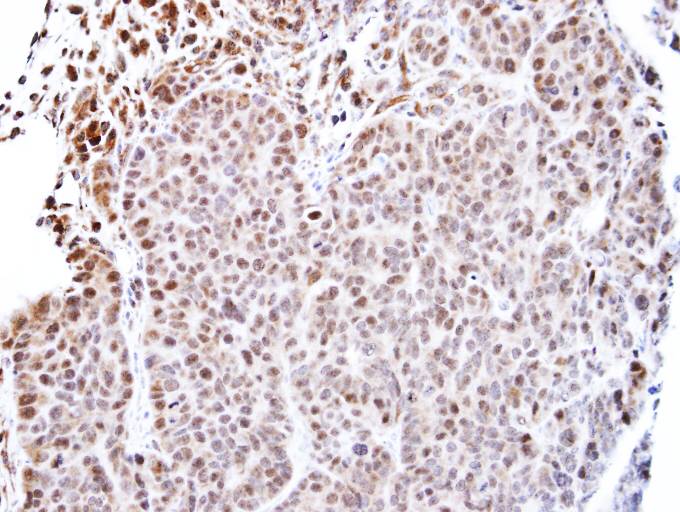 IHC of paraffin-embedded SW480 xenograft using TEAD4 antibody at 1:500 dilution.