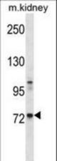 Mouse Tec Antibody western blot of mouse kidney tissue lysates (35 ug/lane). The Tec antibody detected the Tec protein (arrow).