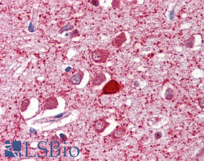 Anti-PVALB / Parvalbumin antibody IHC of human brain, cortex. Immunohistochemistry of formalin-fixed, paraffin-embedded tissue after heat-induced antigen retrieval. Antibody LS-B3601 concentration 2.5 ug/ml.