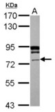 Sample (30 ug of whole cell lysate) A: A431 7.5% SDS PAGE TEC antibody diluted at 1:1000