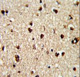 Formalin-fixed and paraffin-embedded human brain reacted with TECPR1 Antibody , which was peroxidase-conjugated to the secondary antibody, followed by DAB staining. This data demonstrates the use of this antibody for immunohistochemistry; clinical relevance has not been evaluated.