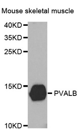 Western blot analysis of extracts of Mouse skeletal muscle tissue, using PVALB antibody.