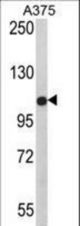 Western blot of PALA Antibody in A375 cell line lysates (35 ug/lane). PALA (arrow) was detected using the purified antibody.