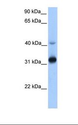721_B cell lysate. Antibody concentration: 1.0 ug/ml. Gel concentration: 12%.