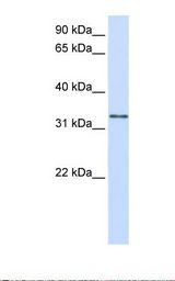 293T cell lysate. Antibody concentration: 1.0 ug/ml. Gel concentration: 12%.