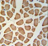 GPSN2 Antibody IHC of formalin-fixed and paraffin-embedded skeletal muscle followed by peroxidase-conjugated secondary antibody and DAB staining. This data demonstrates the use of the GPSN2 Antibody for XXXXX??