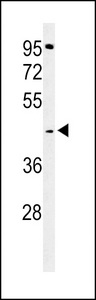 Western blot of GPSN2 Antibody in A2058 cell line lysates (35 ug/lane). GPSN2 (arrow) was detected using the purified antibody.