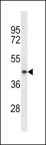SRD5A2L2 Antibody (Ascites)western blot of A549 cell line lysates (35 ug/lane). The SRD5A2L2 antibody detected the SRD5A2L2 protein (arrow).