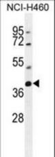 SRD5A2L2 Antibody western blot of NCI-H460 cell line lysates (35 ug/lane). The SRD5A2L2 antibody detected the SRD5A2L2 protein (arrow).