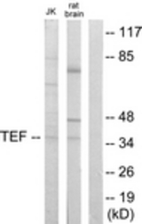 Western blot of extracts from Jurkat/rat brain cells, using TEF Antibody. The lane on the right is treated with the synthesized peptide.
