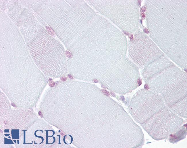 Anti-TEF antibody IHC of human skeletal muscle. Immunohistochemistry of formalin-fixed, paraffin-embedded tissue after heat-induced antigen retrieval. Antibody LS-B6807 concentration 5 ug/ml.