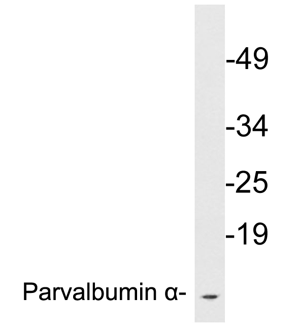 Western blot of extracts from ZR-75-1 cells, using Parvalbumin alpha antibody.