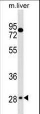 TEF Antibody western blot of mouse liver tissue lysates (35 ug/lane). The TEF antibody detected the TEF protein (arrow).