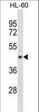 TEKT1 Antibody western blot of HL-60 cell line lysates (35 ug/lane). The TEKT1 antibody detected the TEKT1 protein (arrow).