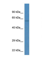 TEKT3 antibody LS-C135460 Western blot of Rat Muscle lysate. Antibody concentration 1 ug/ml.