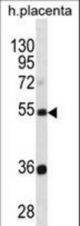 TEKT3 Antibody western blot of human placenta tissue lysates (35 ug/lane). The TEKT3 antibody detected the TEKT3 protein (arrow).