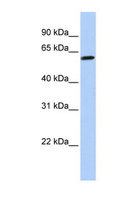 TEKT4 antibody LS-C102460 Western blot of HeLa lysate.