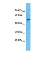 Western blot of Human 721_B. TEKT5 antibody dilution 1.0 ug/ml.