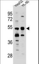 TEKT5 Antibody western blot of HepG2,HL-60 cell line lysates (35 ug/lane). The TEKT5 antibody detected the TEKT5 protein (arrow).