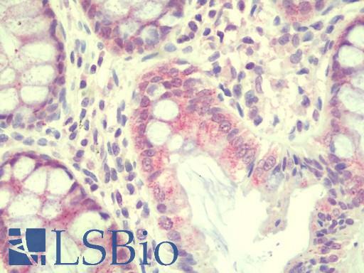 Anti-TEKT5 antibody IHC staining of human colon. Immunohistochemistry of formalin-fixed, paraffin-embedded tissue after heat-induced antigen retrieval. Antibody LS-B9521 concentration 10 ug/ml.