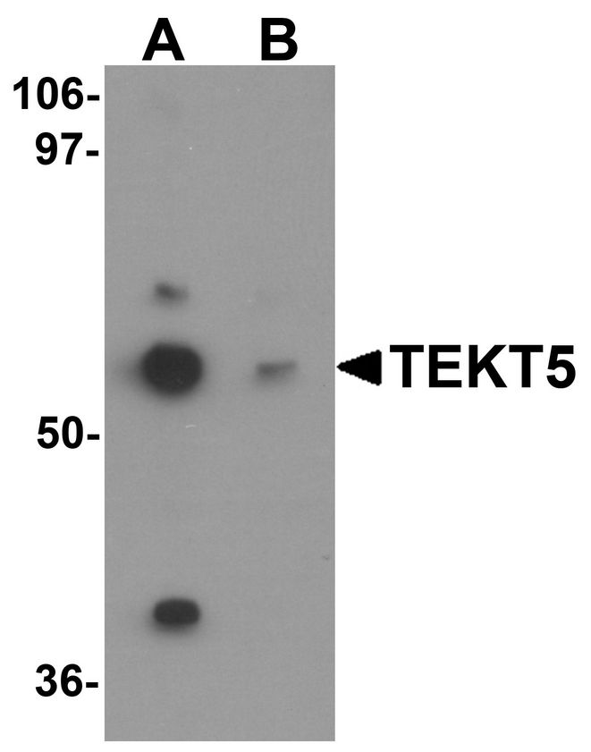 Western blot analysis of TEKT5 in 3T3 cell lysate with TEKT5 antibody at (A) 0.25 and (B) 0.5 ug/ml.