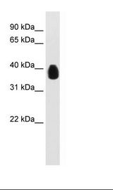 Transfected 293T Cell Lysate