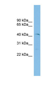 ETV7 antibody LS-C116147 Western blot of ACHN lysate.